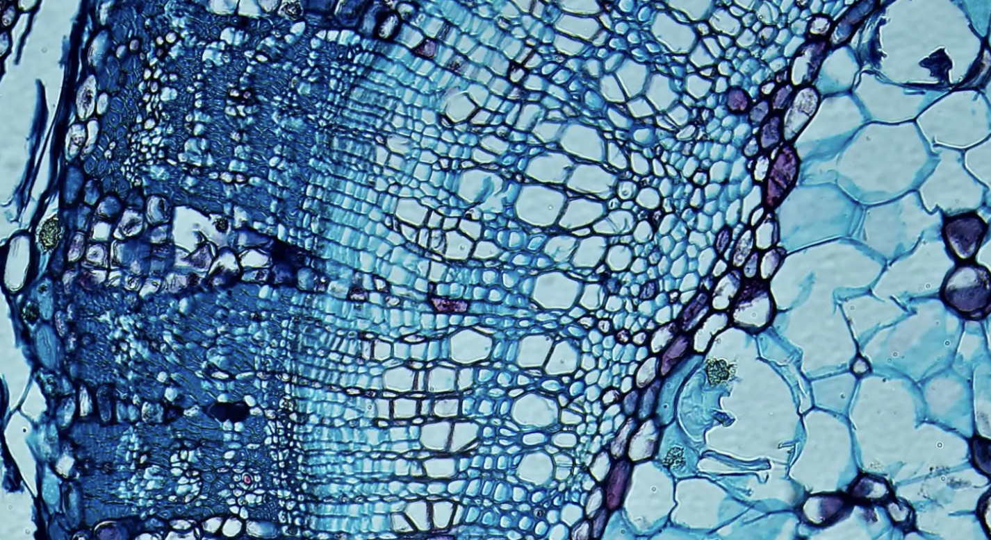 Another tissue sample